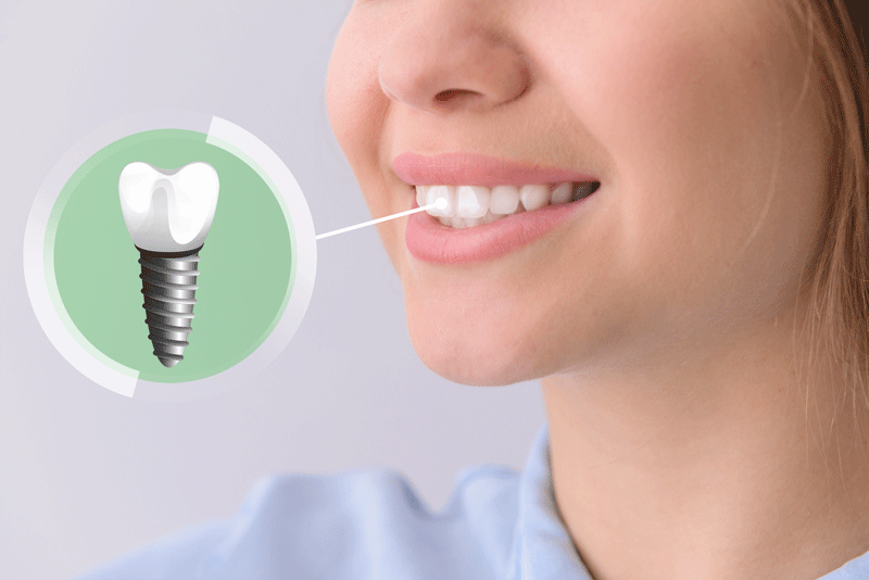 prosthodontic care