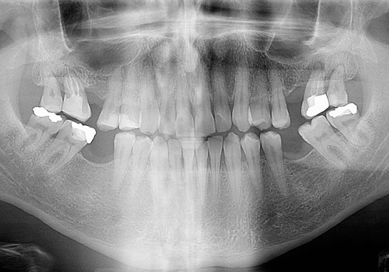 dental xray