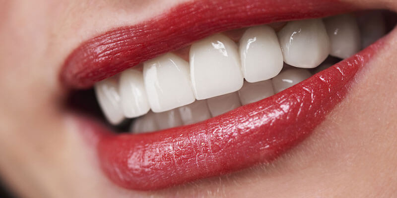 preventative dentistry patient smiling