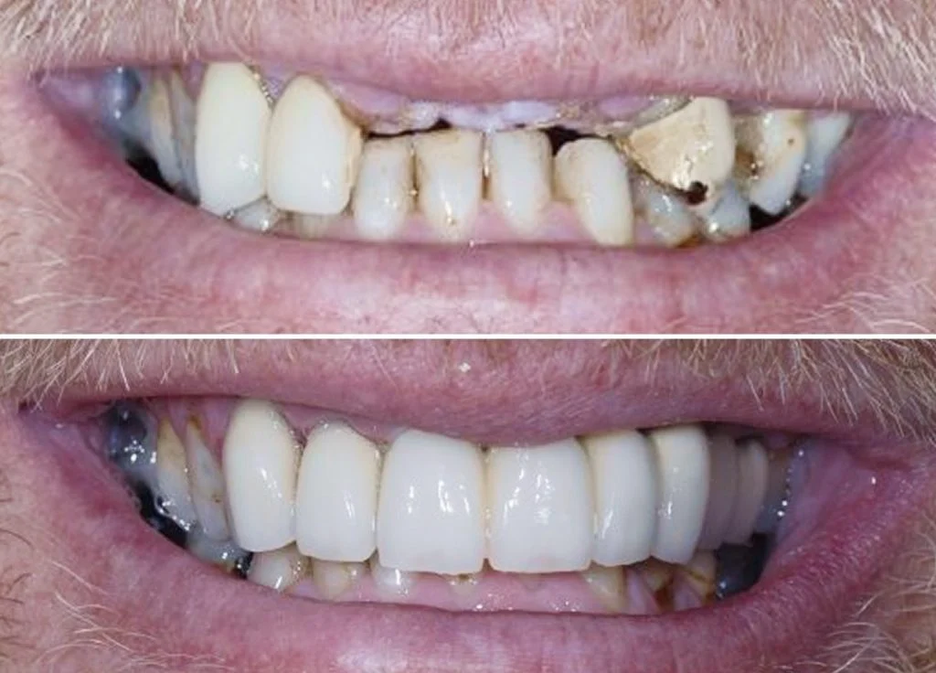 Smile Gallery Single-3