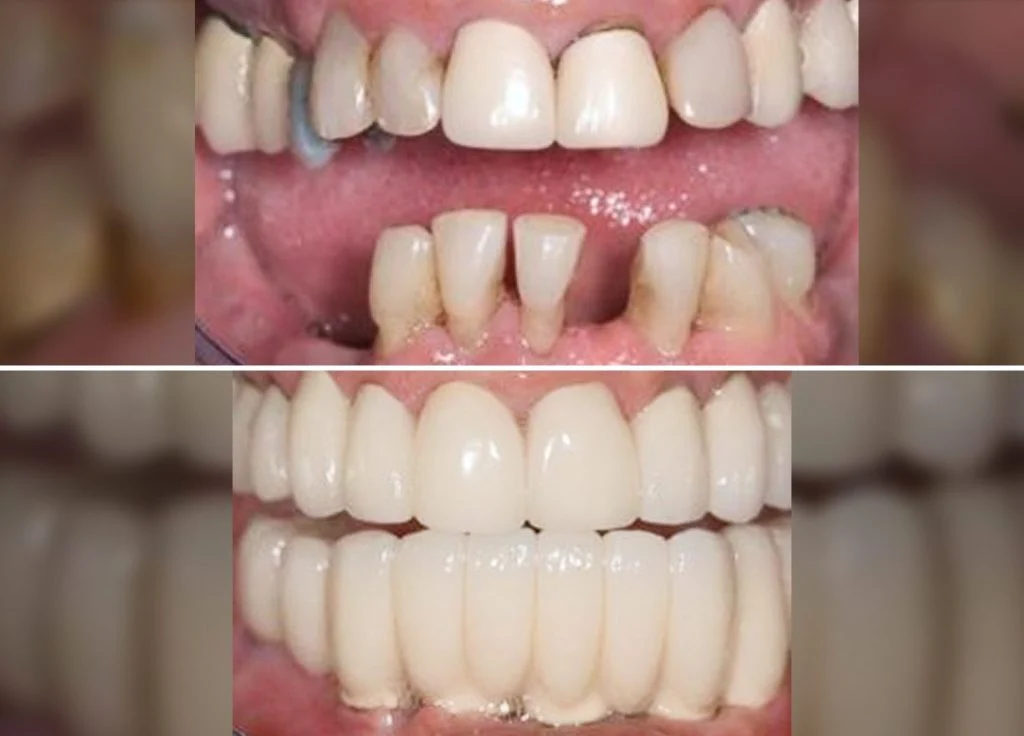 Smile Gallery Single-6