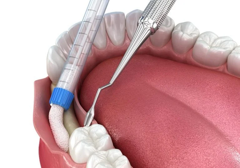 image dental service | Imagine Your Smile
