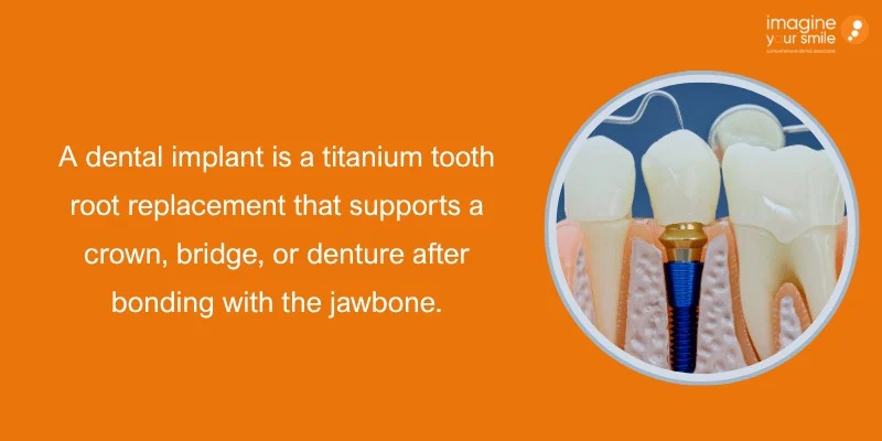 How Dental Implants Work