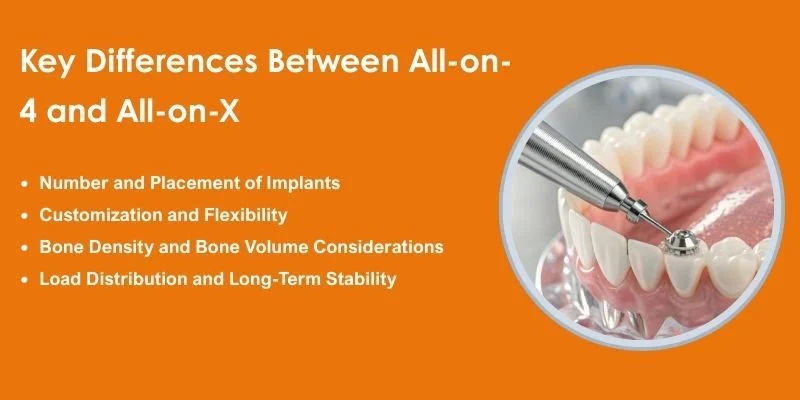 Key Differences Between All-on-4 and All-on-X