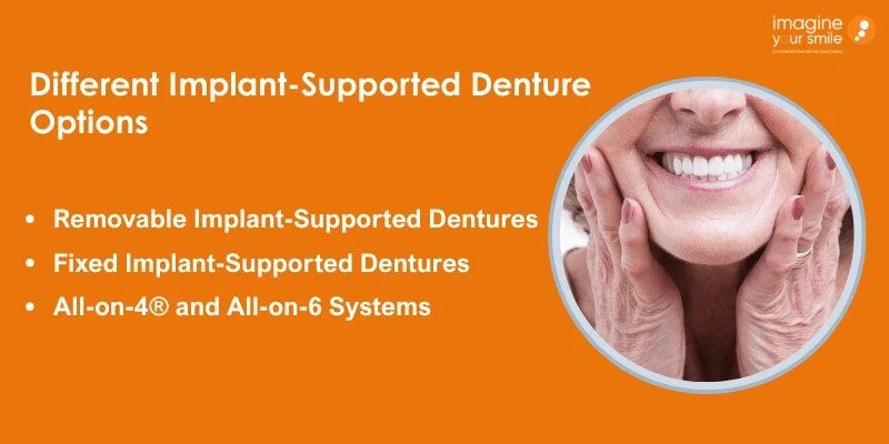 Types of Implant-Supported Dentures