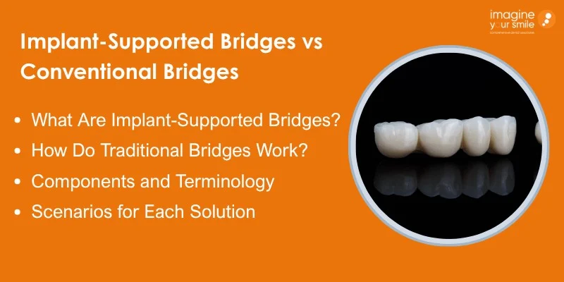 Understanding Implant-Supported and Traditional Dental Bridges