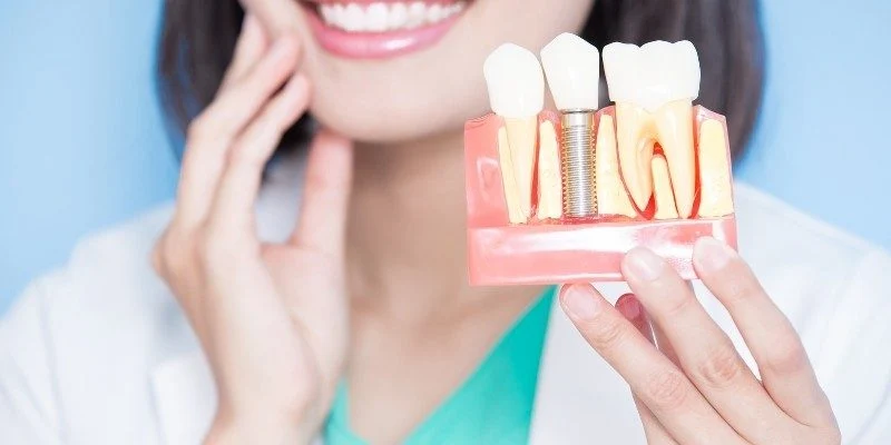 Comparing Dental Implants, Dentures, and Bridges