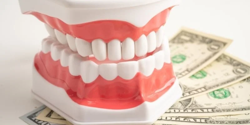 cost of dental implants in woodbury MN