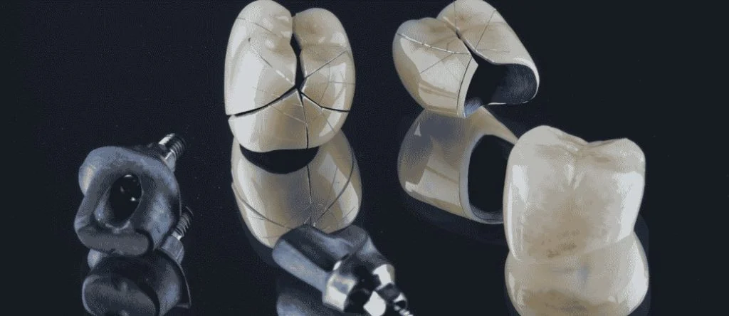 cracked dental crown repair
