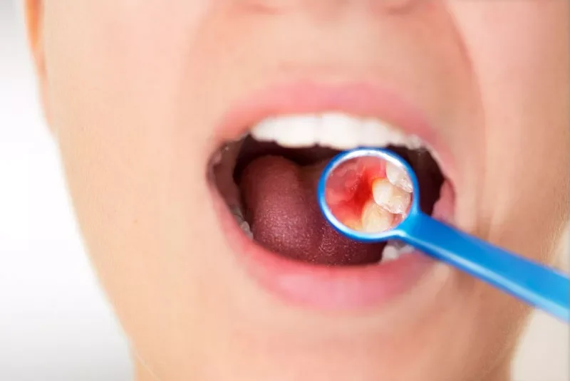 dental patient in need of periodontal treatment 1