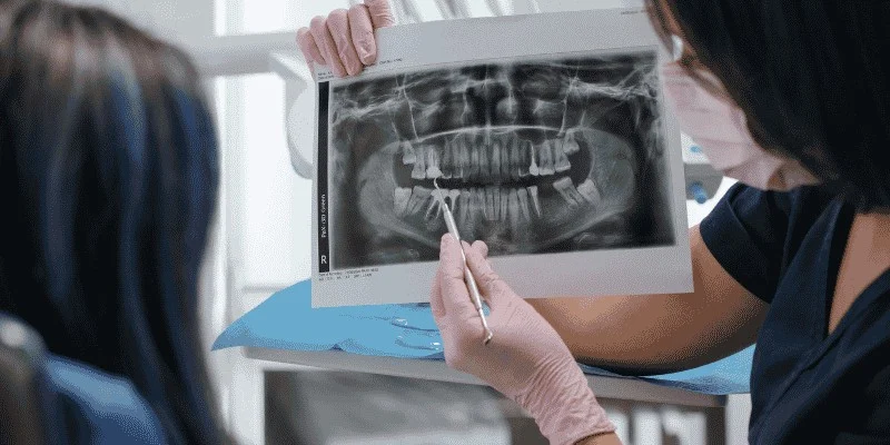 digital smile design for dental implants