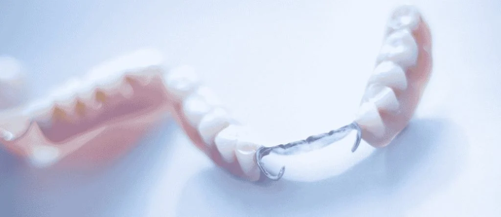 failing removable partial denture