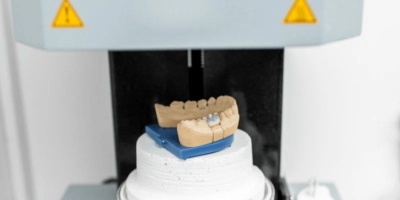 future of dental implants with 3d printing