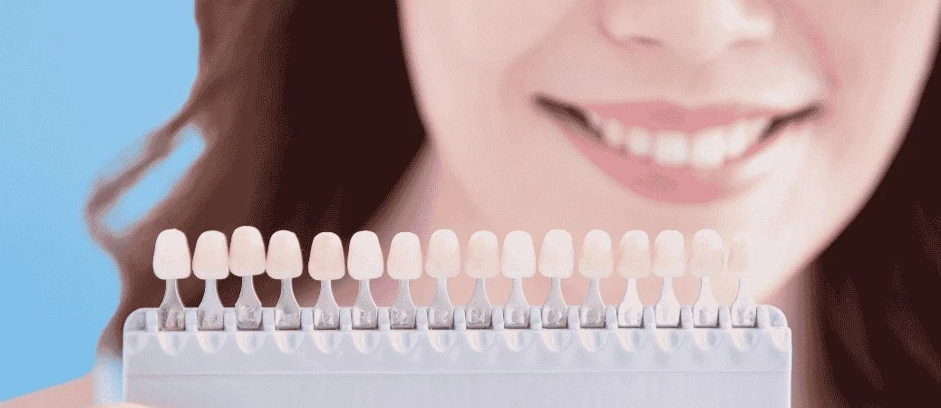 veneers vs teeth contouring